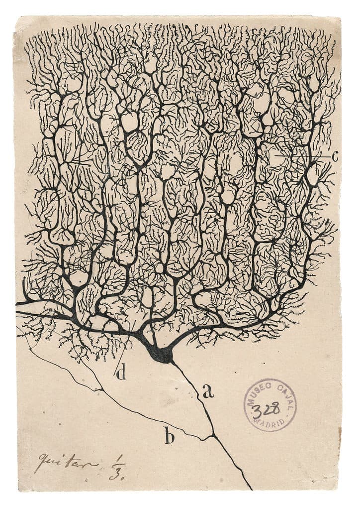 A Purkinje neuron from the human cerebellum